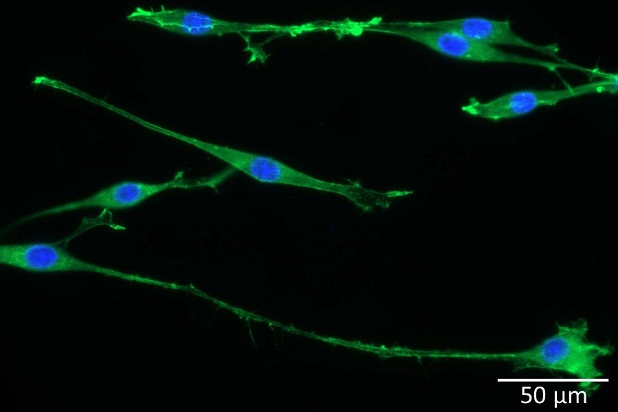 Neuronale Zellen ausgerichtet mit lasergenerierten nano ripples auf PEEK-Oberfläche.