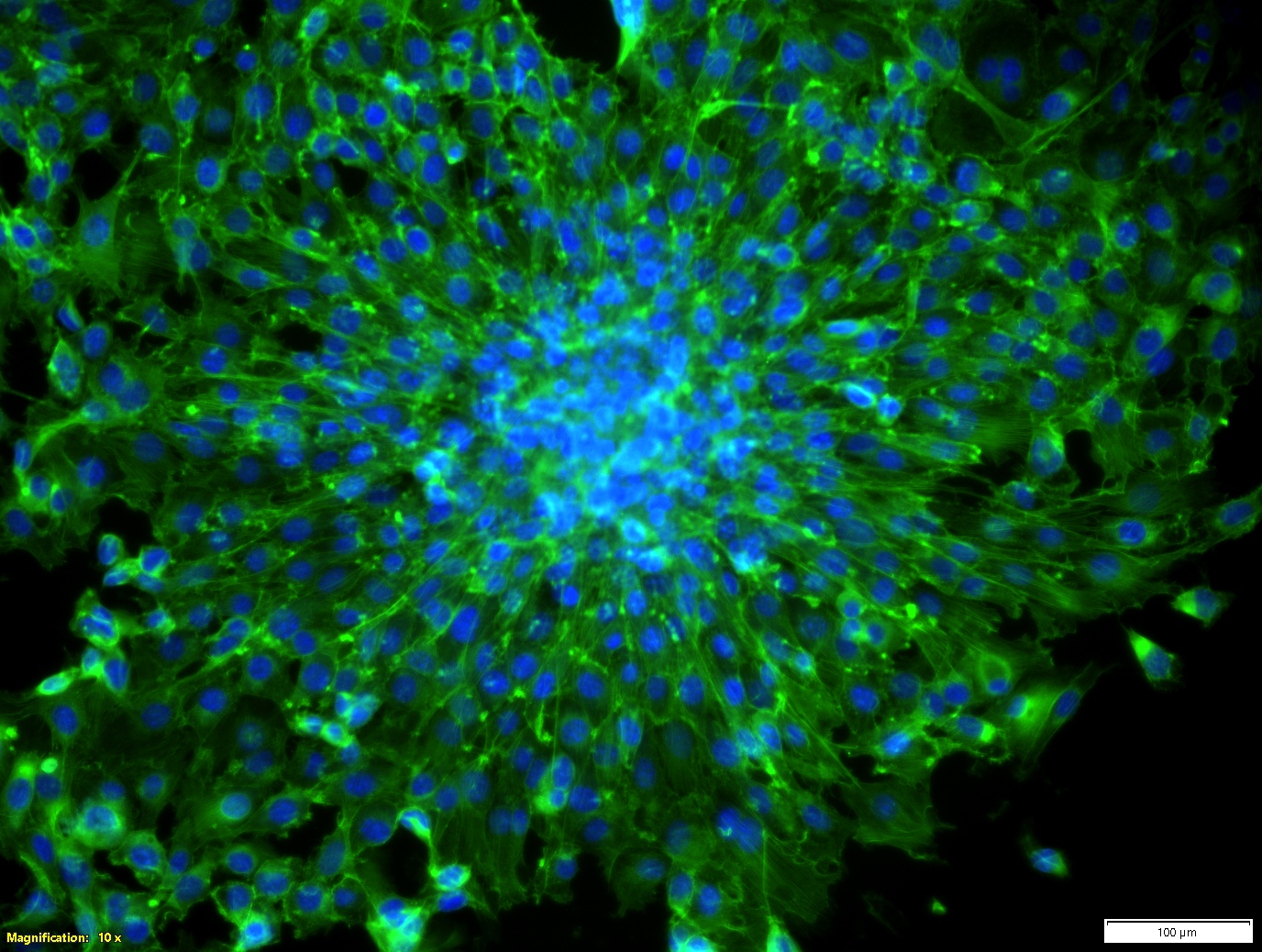 Actin stained 3T3 fibroblast spheroid for LIFT transfer cultured in laser fabricated microcups.