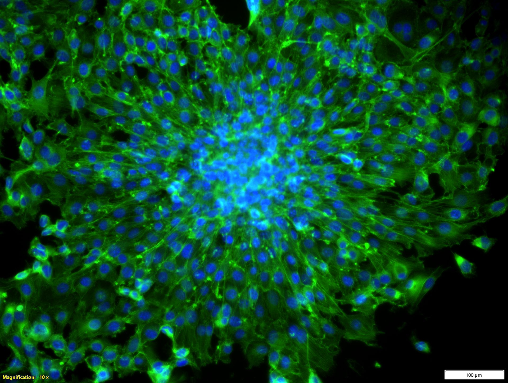Actin stained 3T3 fibroblast spheroid for LIFT transfer cultured in laser fabricated micro wells.