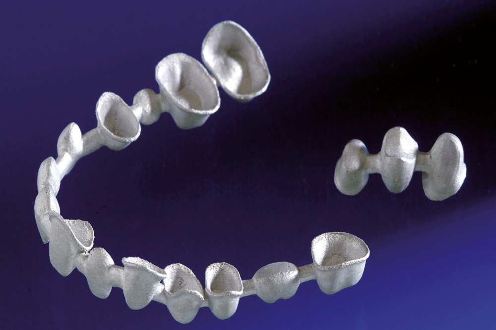 Individualisierte Dentalkronen und -käppchen.